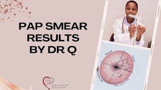 Explaining Pap Smear Results [upl. by Gluck738]