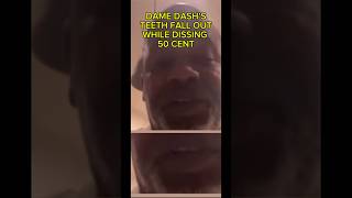 DAME DASH’S TEETH FALL OUT WHEN RESPONDING TO 50 CENT ON LIVE STREAM 🦷😬 damedash 50cent teeth [upl. by Idnaj199]