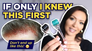 The Dermaroller Watch This BEFORE Microneedling What I wish I knew Before I Started Dermarolling [upl. by Micro]