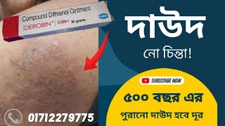 দাউদেরদাদ ও চুলকানির সবচেয়ে ভালো ঔষধ ডেরোবিনडेरोबिन क्रीम किस काम में आता है  দাদের ওষুধ Derobin [upl. by Ebeohp]