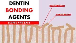 Dentine bonding agents [upl. by Nosredna]