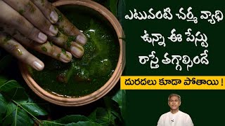 Home Remedy to Treat Skin Rashes  Reduces Itching  Skin Infections  Dr Manthenas Beauty Tips [upl. by Peers]