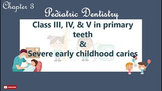 Class IIIIV and V caries in primary teeth  severe early childhood caries [upl. by Standing]