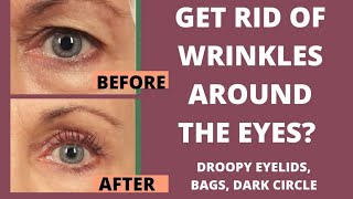 FACE YOGA FOR WRINKLES AROUND EYES  GET RID OF WRINKLES  dark circles [upl. by Krefetz]