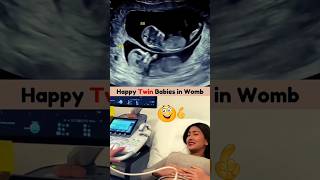 Emotional Twin Ultrasound Scan 🥰💯 Twin ultrasound pregnancy [upl. by Cele203]