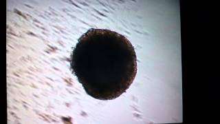 Beating 10 day old embryoid body from mES cells [upl. by Ehsiom]