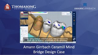 AMANN GIRRBACH CERAMILL MIND BRIDGE CASE DESIGN [upl. by East]