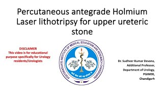 Percutaneous antegrade PCNL Holmium Laser lithotripsy of upper ureteric stone [upl. by Nosac861]