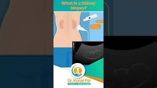 What is a kidney biopsy  Dr Kunal Pai  Pediatric Nephrologist [upl. by Tab]