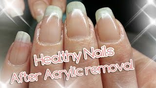 Acrylic Nail Removal  For Healthy Nails [upl. by Forbes]