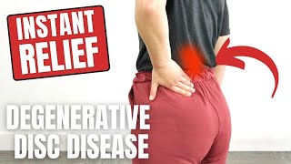 Advanced Degenerative Disc Disease Rehab Exercises [upl. by Lean463]