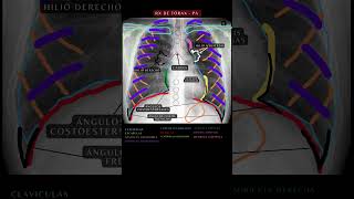 Radiografía de Tórax PA  Anatomía del Tórax radiografía anatomía medicina [upl. by Julissa]