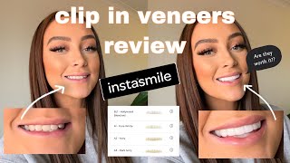 I GOT CLIP IN VENEERS INSTASMILE REVIEW Are clip in Veneers WORTH IT  Ellie Dawe [upl. by Elaval]