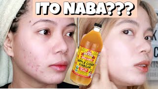 APPLE CIDER VINEGAR TONER DIY REVIEW EFFECTIVE ba talaga sya [upl. by Nalced]