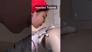 Injection Tutorial tutorial injection shorts littos [upl. by Maxfield]