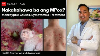 Nakakahawa ba ng Mpox Monkeypox Causes risk factors symptoms treatment and prevention [upl. by Addiego]