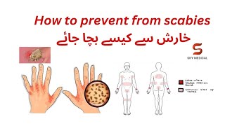 HOW TO PREVENT SCABIES خارش سے کیسے بچا جائے EASY TO UNDERSTAND [upl. by Tychon]