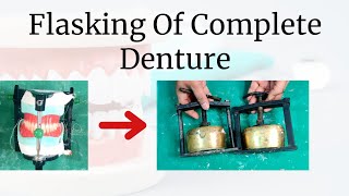 Flasking of Complete Denture [upl. by Pytlik]