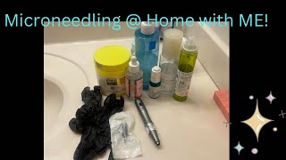 Microneedling at Home [upl. by Udale]