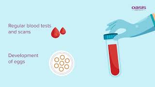 Intrauterine Insemination IUI  Oasis Fertility [upl. by Nwhas]