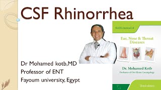 CSF rhinorrhea Professor Dr Qotb [upl. by Follansbee]