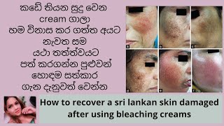 How to recover a sri lankan skin damaged after using bleaching creams in sinhala  pavithra peiris [upl. by Tullius]