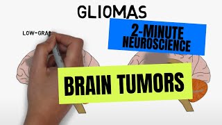 2Minute Neuroscience Brain tumors [upl. by Fang]