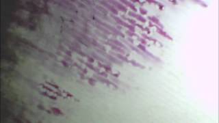 ONION CELLS PLASMOLYSE [upl. by Nahtanaj]