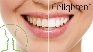 Enlighten Whitening  Gentle Dental Care Group [upl. by Yleik]