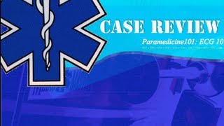 Paramedicine101 ECG Case 10 [upl. by O'Neill]