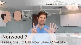 Norwood 7  Norwood Men’s Hair Loss Scale  Hair Transplant for Norwood 7 [upl. by Yemiaj]