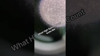 This is what high sperm count looks like  fertility infertility sperm semenhealth [upl. by Eidnahs]