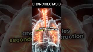 BRONCHIECTASIS biology system pharmacy facts disease news shorts [upl. by Assirral]