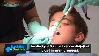 De ce este recomandat aparatul dentar pentru copii  Clinicile Dentare Dr Leahu [upl. by Eimma499]