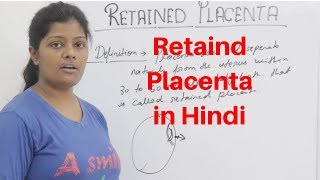 Retained Placenta Lecture in Hindi with Types amp Grades  Complication amp Management [upl. by Timmi]