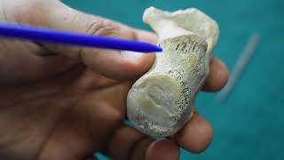 Osteology of Calcaneus [upl. by Ahtekal]