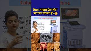 Colour Doppler mashine क्याक्या दिखाती है 🤔🤔 neet gnm medicalequipment hospitaltraining [upl. by Ettener]