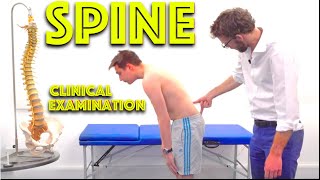 Spine Examination  Back Pain Assessment  4K  Clinical Skills  Dr Gill [upl. by Atinnor]