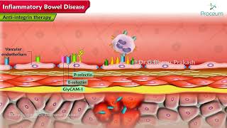 Inflammatory Bowel Disease Pharmacology Lectures [upl. by Auka129]