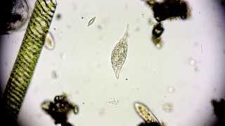 Amphileptus meleagris  Ciliate  Wimpertierchen  Hemiophrys meleagris  microorganisms microscope [upl. by Wallraff]