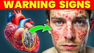 13 Skin Signs of SERIOUS Heart Problems [upl. by Derrik]