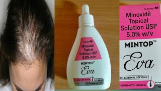 How to use mintop eva 50 solution for hair fall [upl. by Ihcekn]