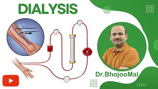 Dialysis  Hemodialysis CRRT  Class 12 Biology  by Dr Bhojoo Mal [upl. by Audie]