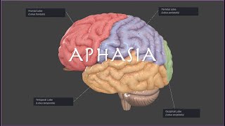 Brocas or Wernickes Aphasia on the NPTE [upl. by Melli906]