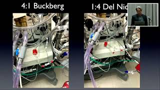 Isolated Cerebral Perfusion during Extra Anatomic Innominate and Left Carotid Artery Revascularizati [upl. by Levitan939]