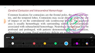 chapter 160 tintinalli emergency medicine head trauma [upl. by Noak]