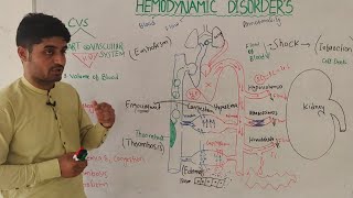 overview of hemodynamic disorders in hindi  hemorrhageshock infarction edema etc  by Dr aqib [upl. by Allebara]