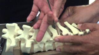 APSS Workshop Video 2 Thoracic Pedicle Screw [upl. by Annael152]