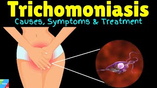 Trichomoniasis Causes Symptoms Diagnosis Treatments and prevention [upl. by Brotherson]