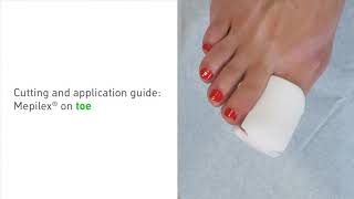 How to apply Mepilex on a toe [upl. by Adnerak276]